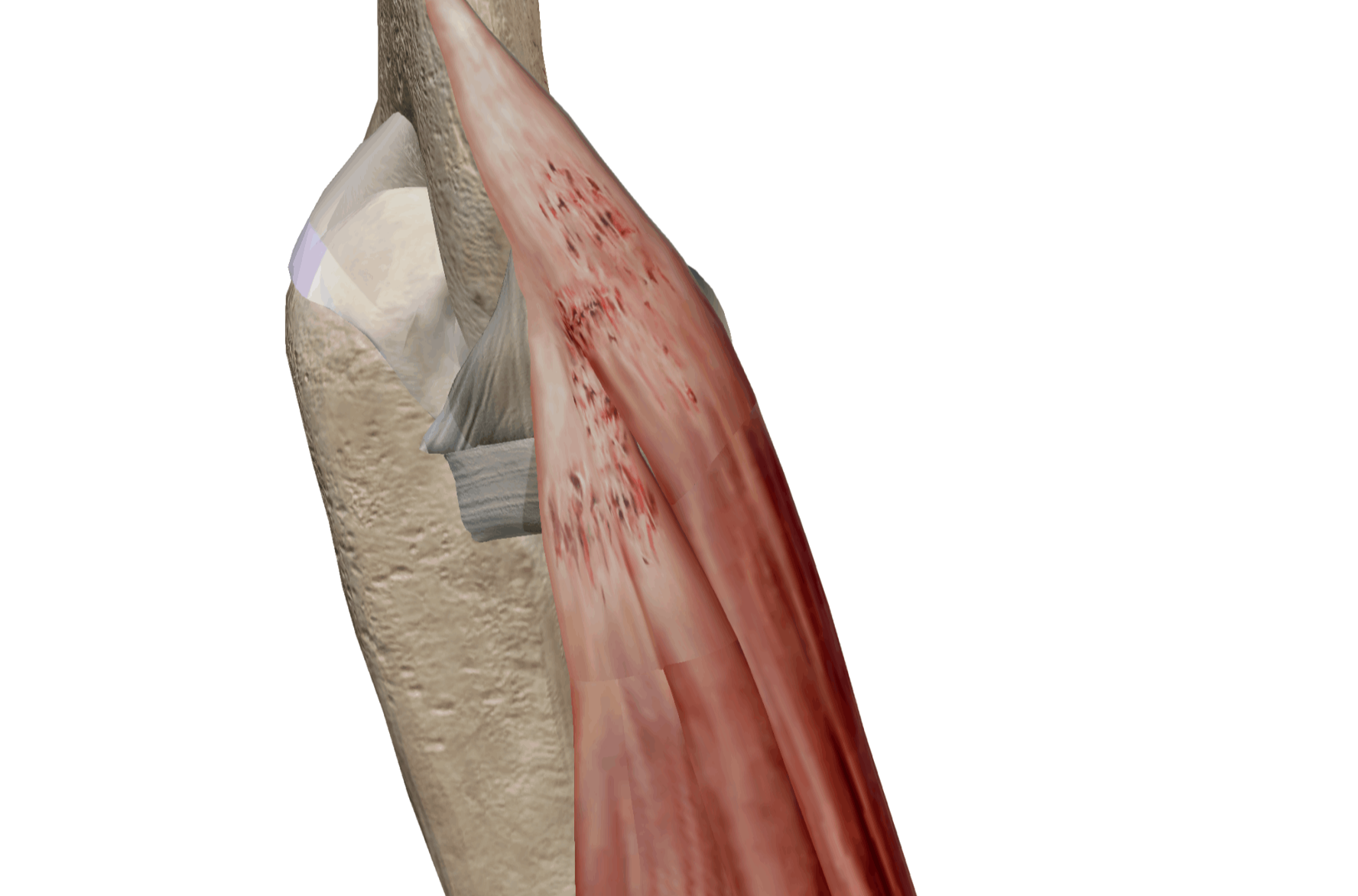 Épicondylite